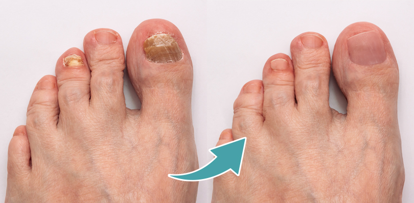 DERMATOLOŠKE INFORMACIJE