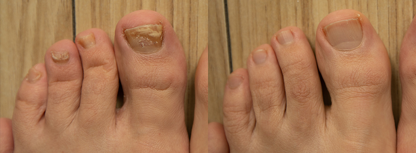 DERMATOLOŠKE INFORMACIJE